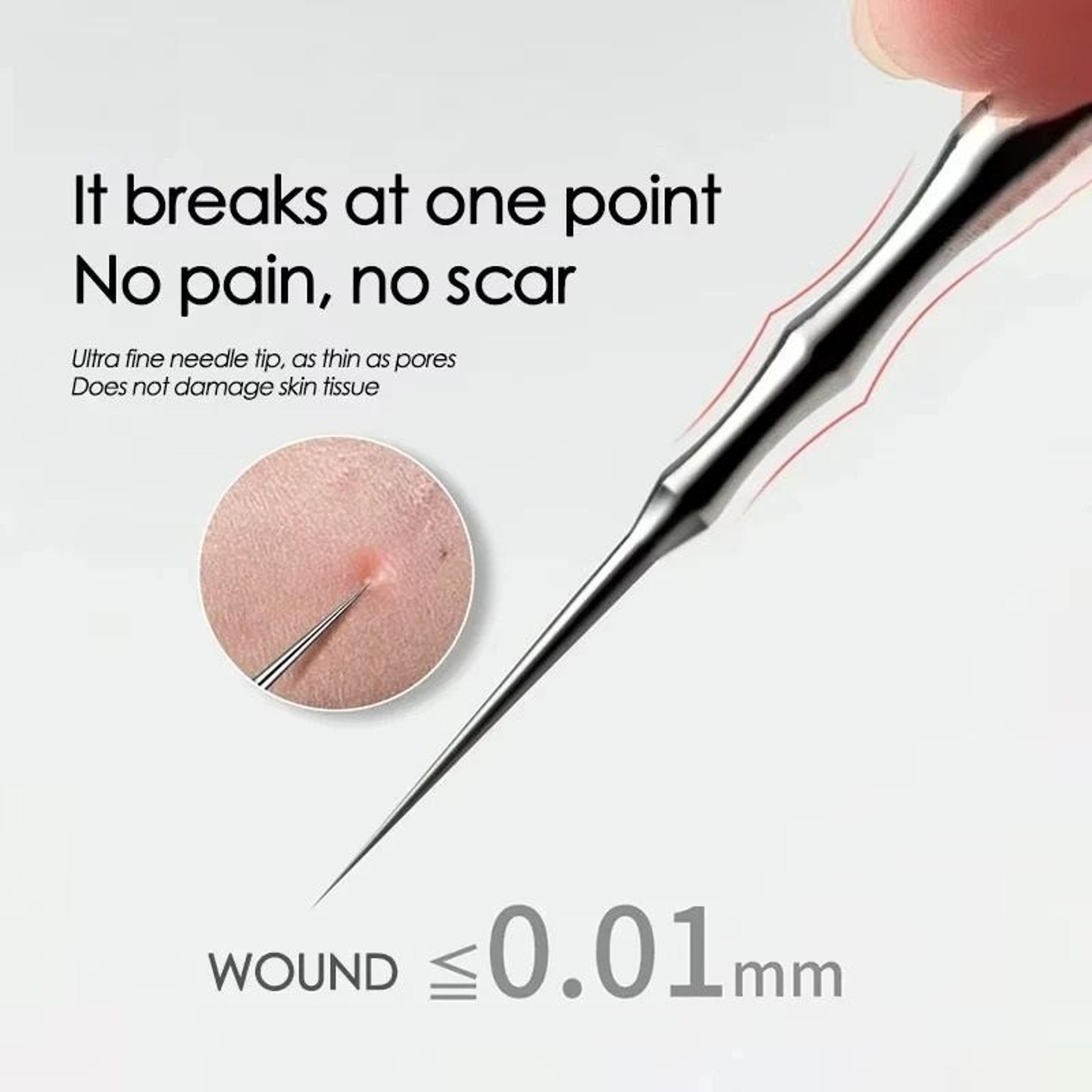 professional grade german stainless steel acne and blackhead removal tweezers