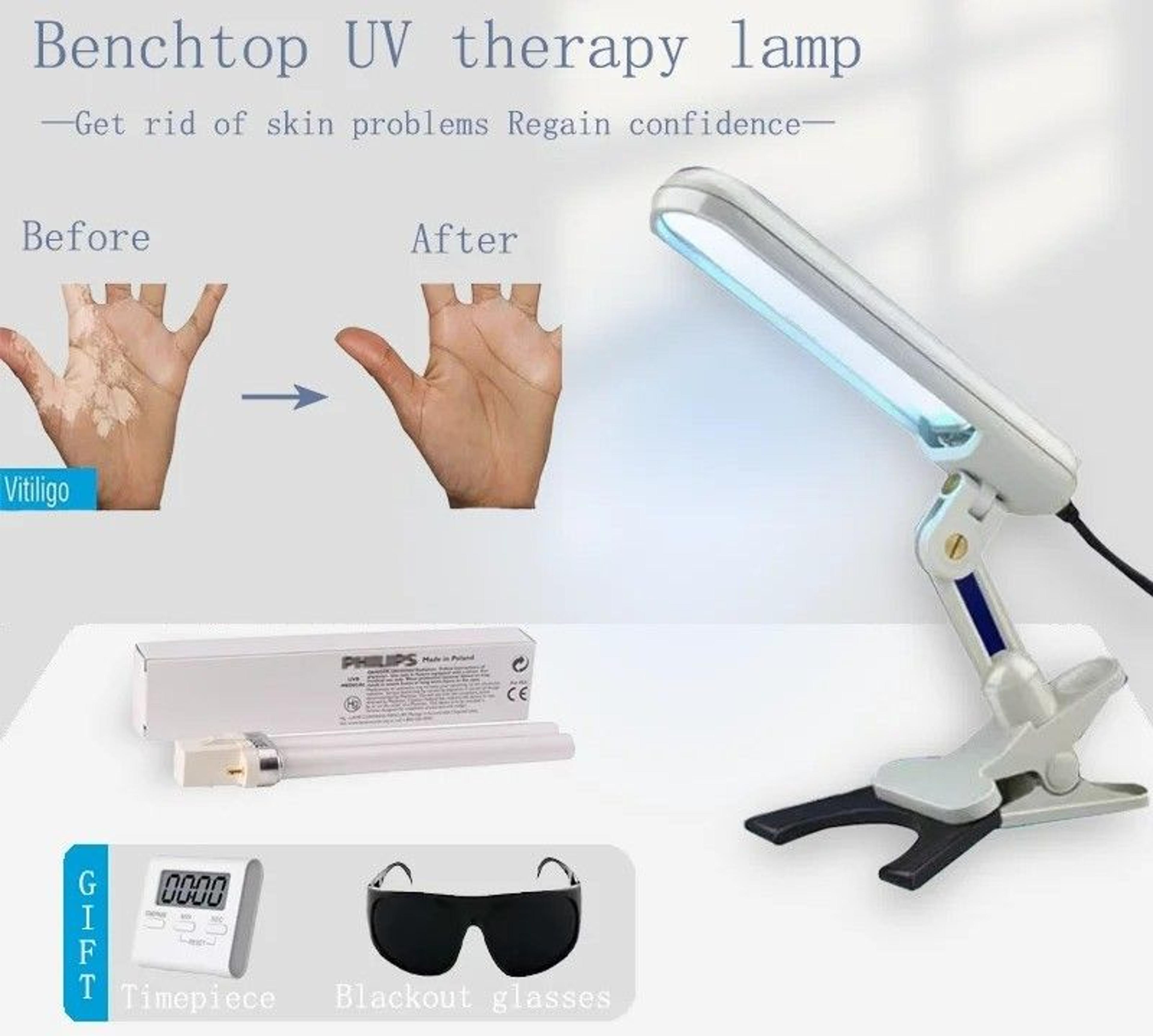 narrowband uvb 311nm phototherapy lamp for skin irritation