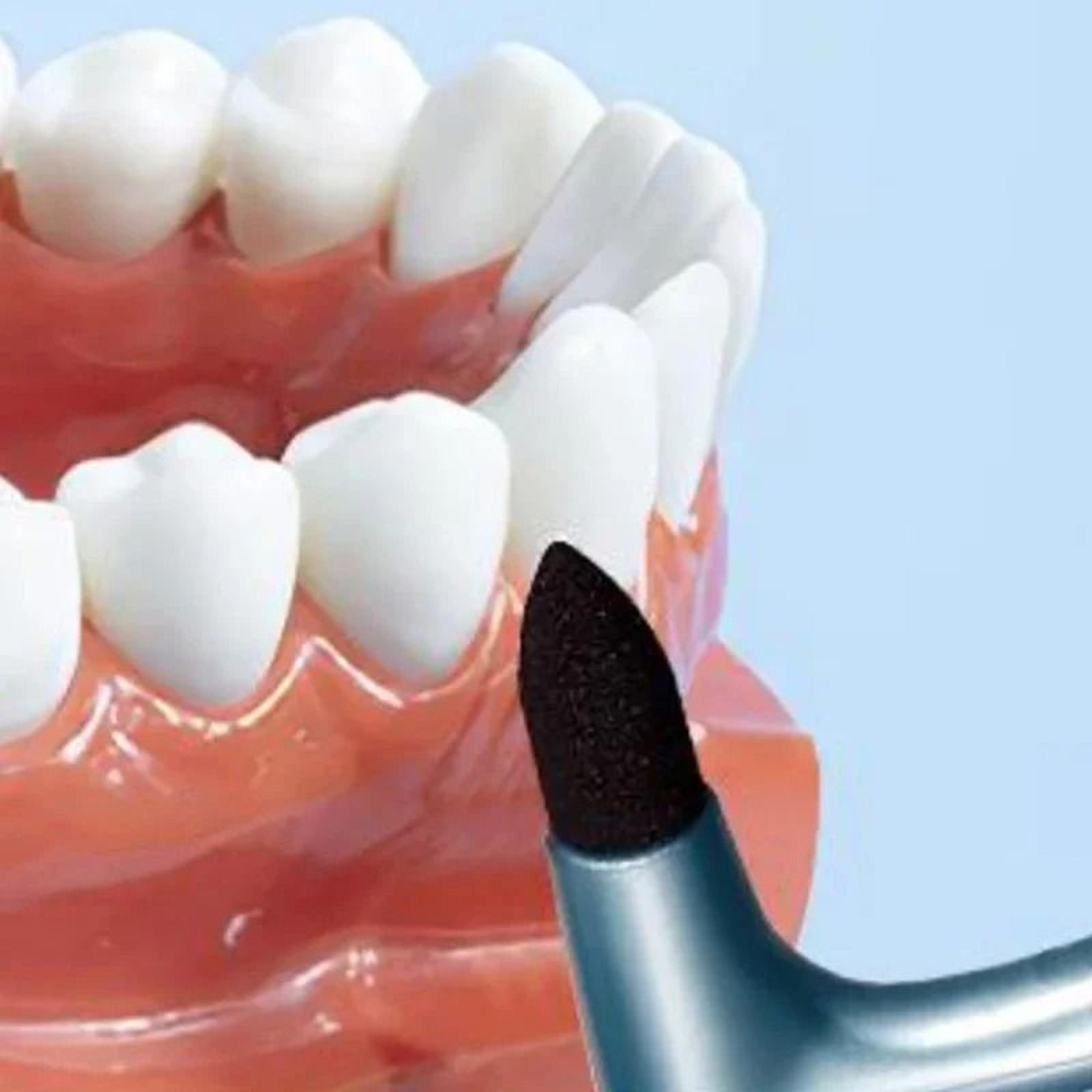 orthodontic interdental single-tuft soft toothbrush for dental braces and implant cleaning