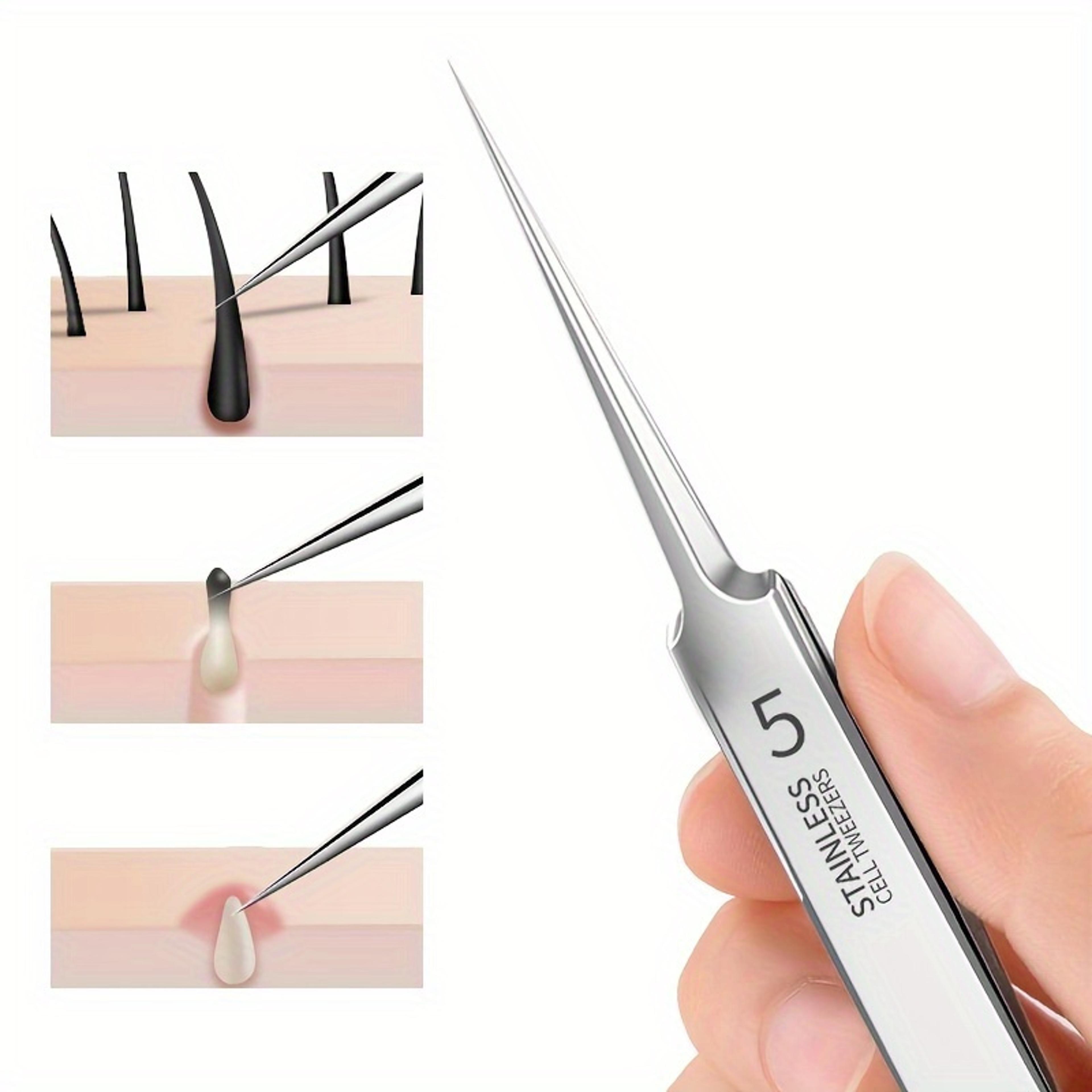 stainless steel acne extractor set, hypoallergenic beauty tweezers for clear skin, easy-to-use, ideal for beginners