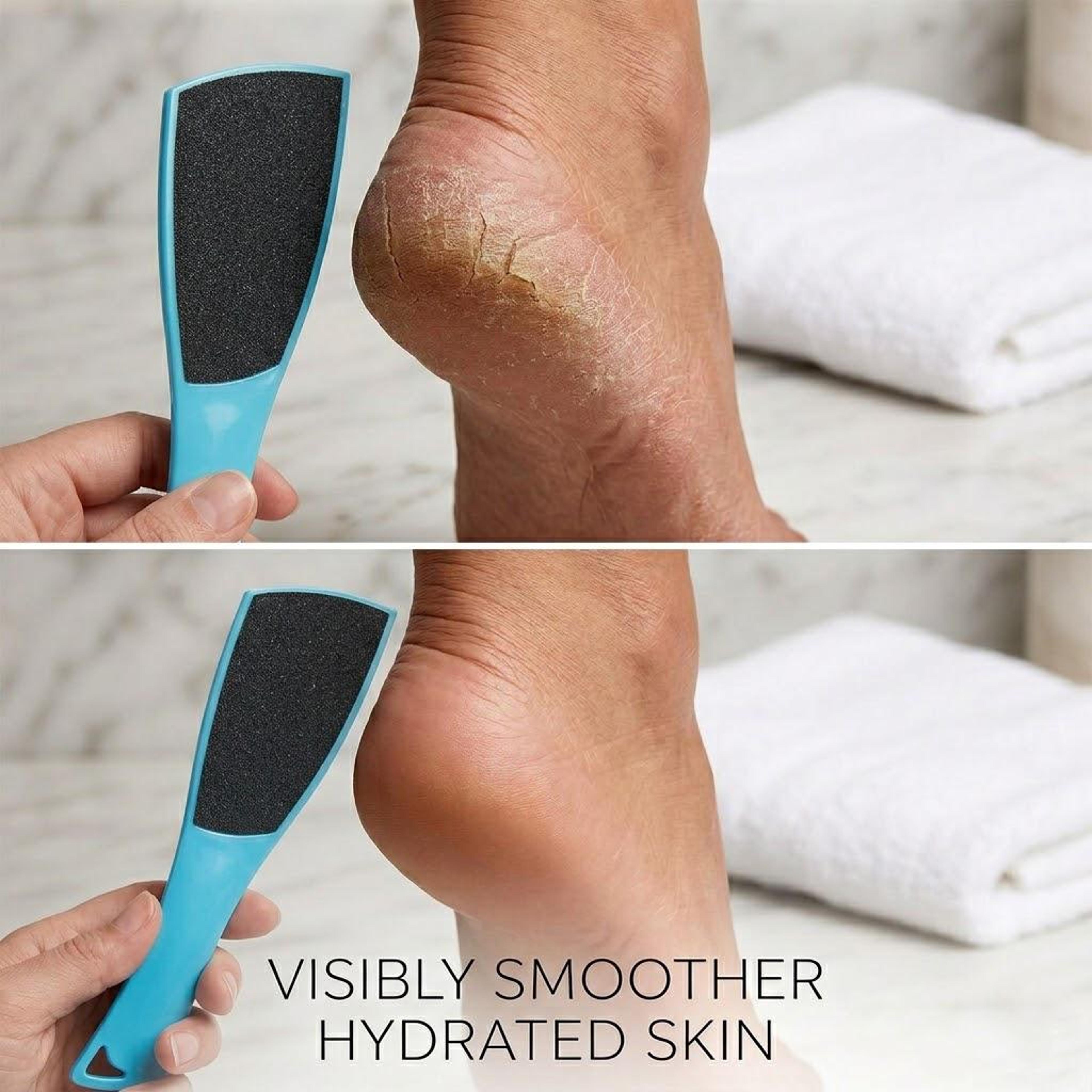 double-sided foot file callus remover for soft, healthy feet