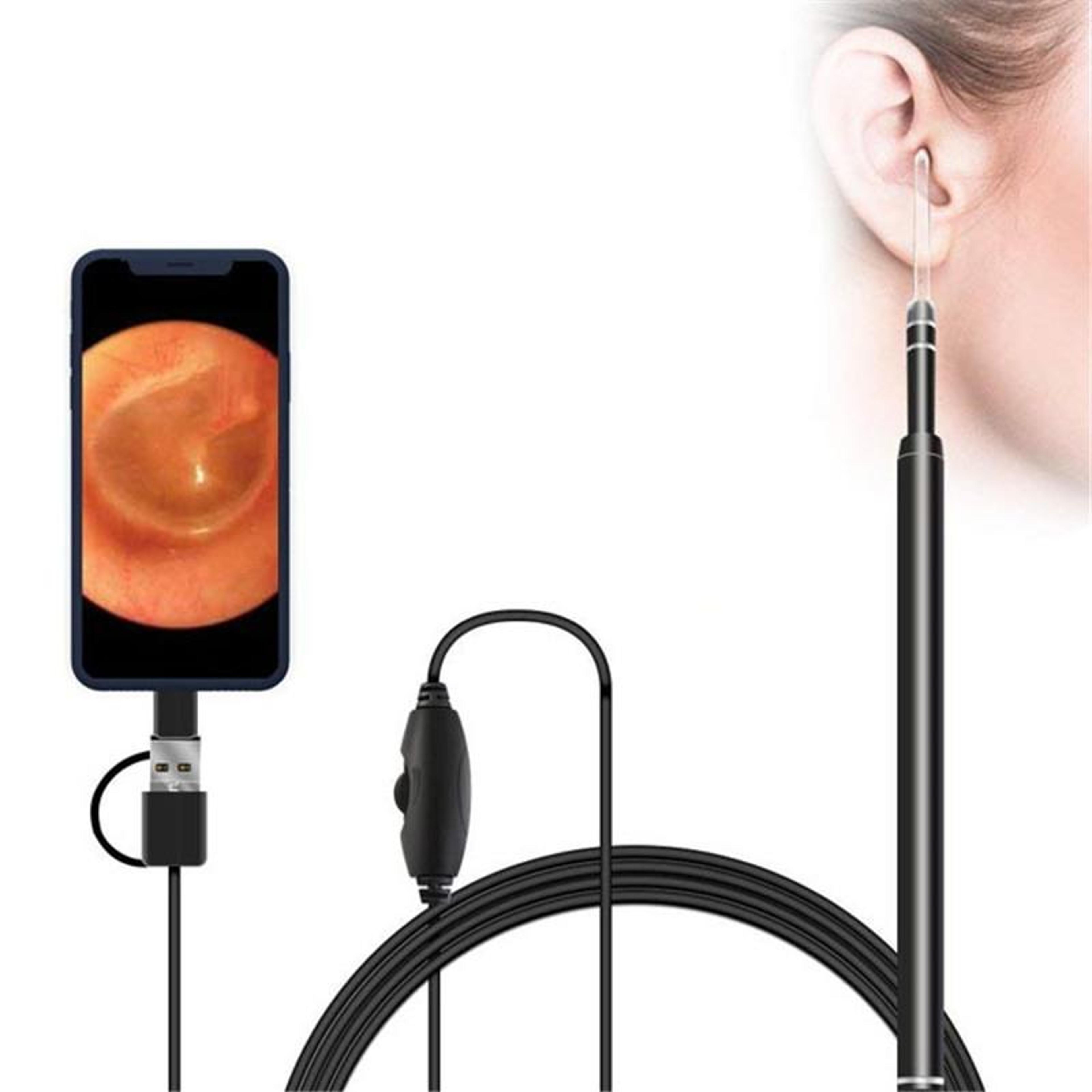 3-in-1 usb digital otoscope ear camera with 6 led lights for android, windows & mac
