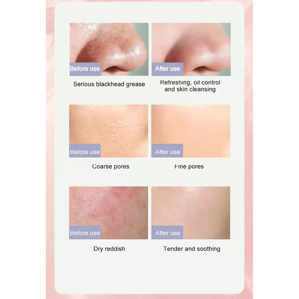 Purifying Green Tea Clay Mask Stick Deep Cleansing Blackhead Remover Acne Treatment For All Skin T 2