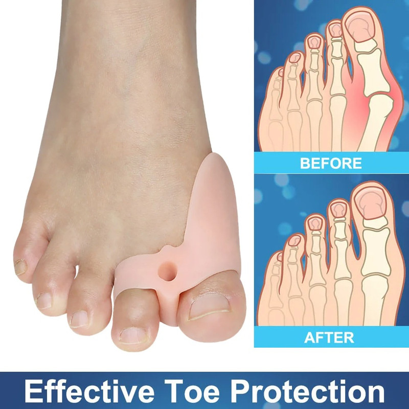 Pexmen Soft Bunion Corrector Toe Separators & Spacers for Bunion Relief Cushion Protector with Gel Shield Foot Care