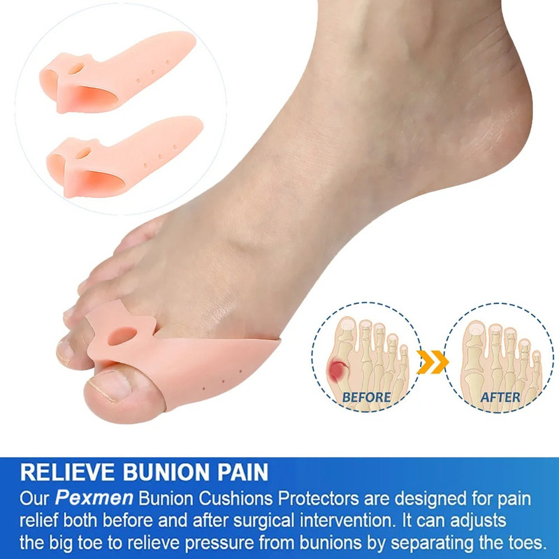 Pexmen Soft Bunion Corrector Toe Separators & Spacers for Bunion Relief Cushion Protector with Gel Shield Foot Care