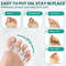 Silicone Toe Separator Bunion Corrector Soft Hammer Toe Straightener  Toe Alignment Foot Care Tool  1