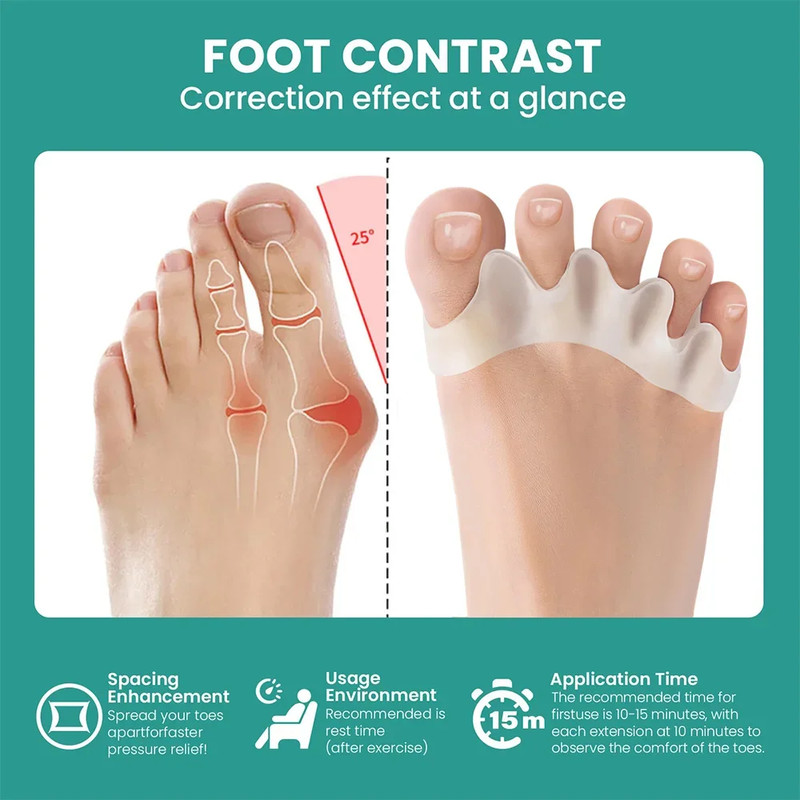 Silicone Toe Separator Bunion Corrector Soft Hammer Toe Straightener  Toe Alignment Foot Care Tool  2