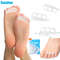 Sumifun Silicone White Toe Separator for Bunion, Hallux Valgus & Overlapping Toes, Foot Adjuster & Straightener Health