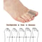 Hallux Valgus Bunion Corrector With Two Toe Separator Orthotics Feet Bone Adjuster Thumb Straighten 5