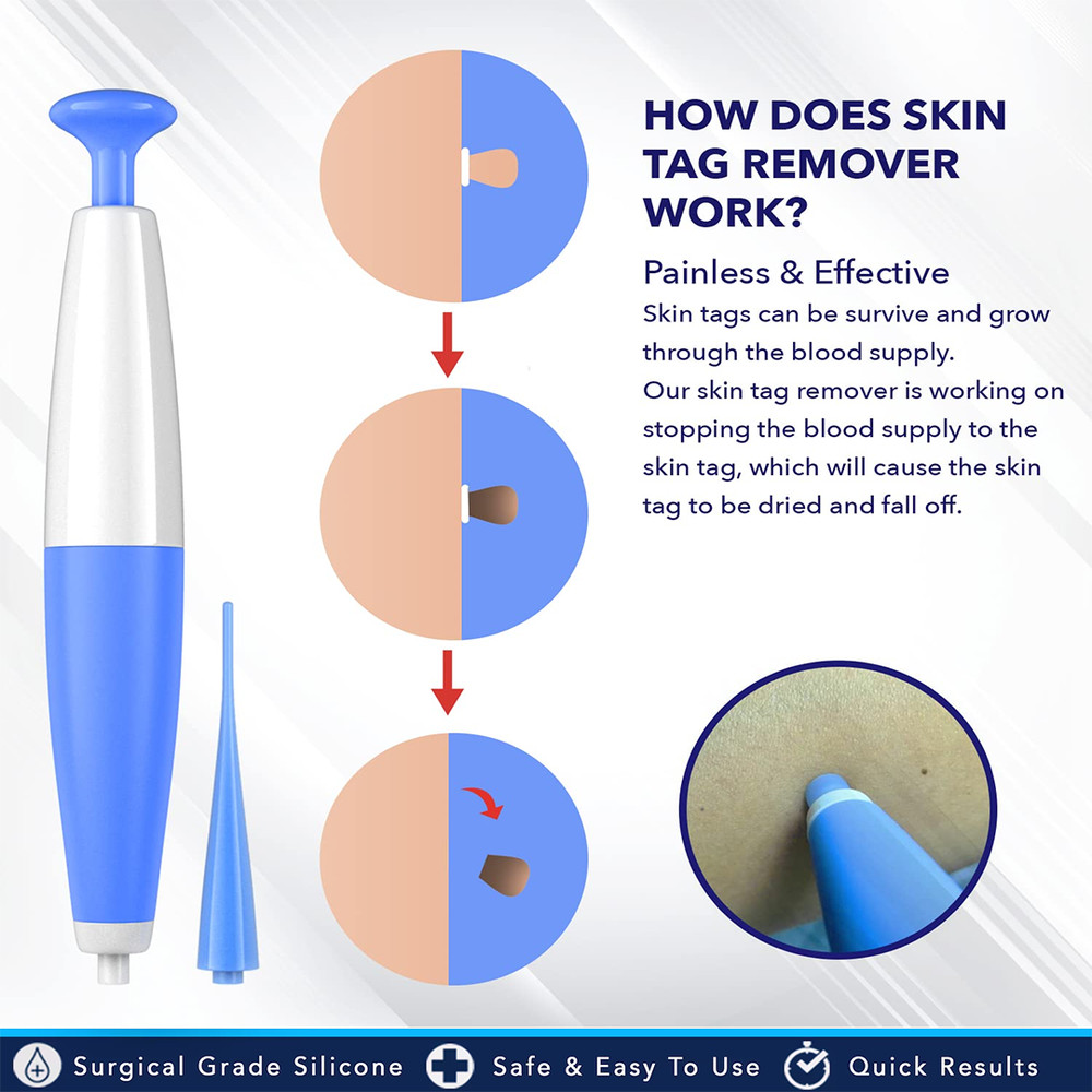 Skin Tag Removal Tool