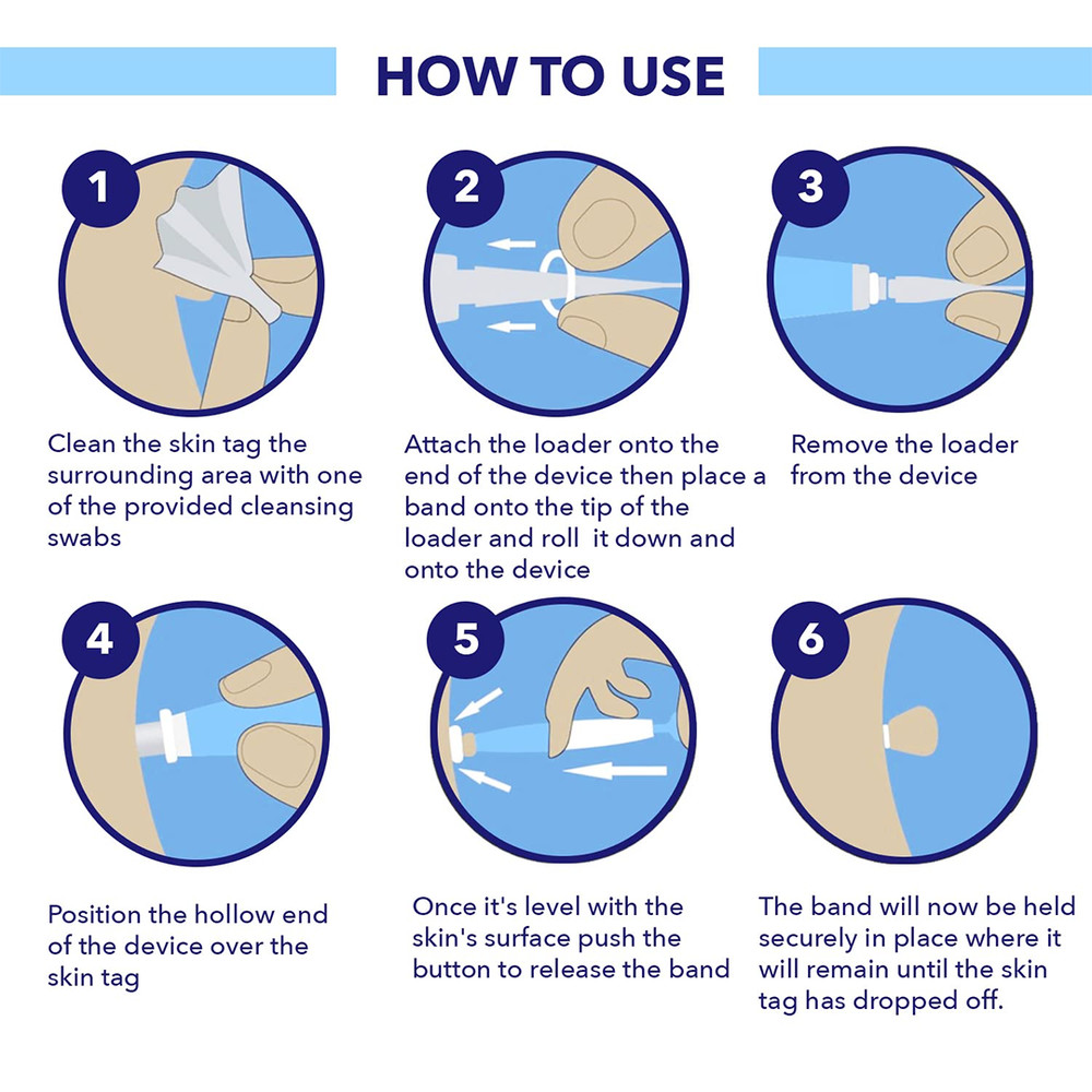 Remove Skin Tags