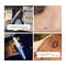 Skin Tag Removal Kit