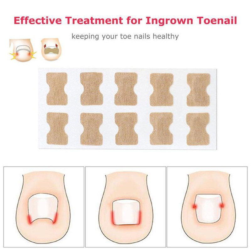 Quick and easy toenail patch application