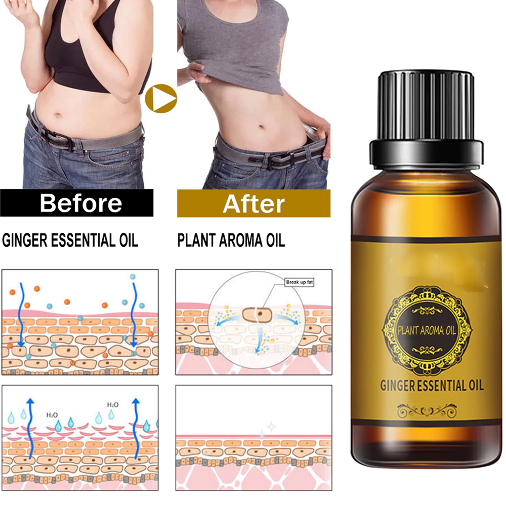 Best ginger oil for reducing varicose veins