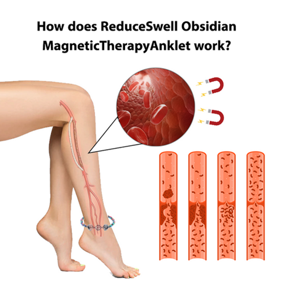 Natural Edema Reduction with Obsidian Magnetic Anklet