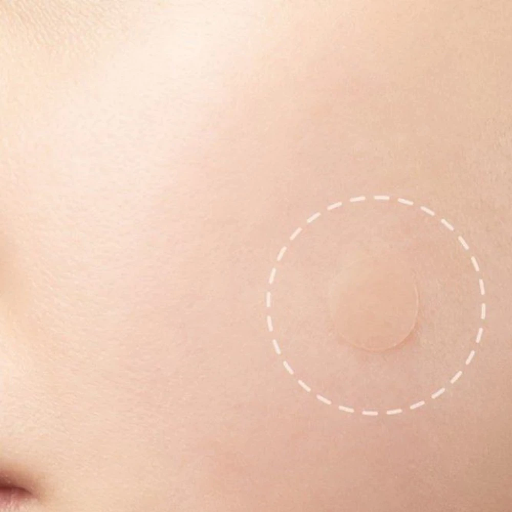 Before and after using mole remover patches