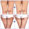 skinniertighteningcellulitereducingthighpatch5png
