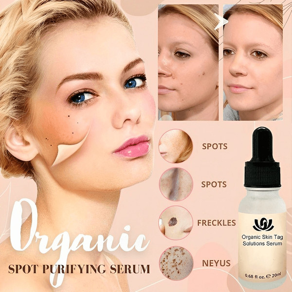 organicskinspotpurifyingserum3.png