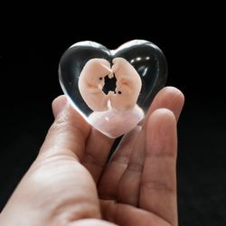 Twins Embryo 8 weeks cast in resin, 8 weeks pregnant, bereavement fetus