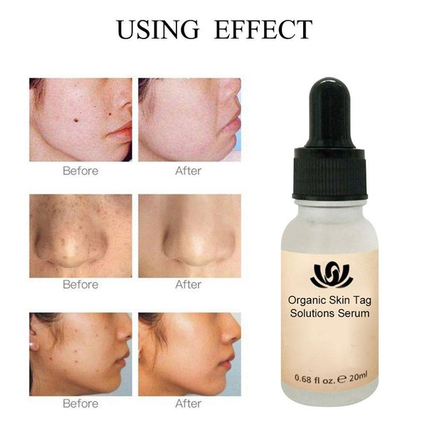 larahorganicskinspotsolutionsserum2.png