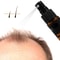 hairregrowthherbalessencespray3.png