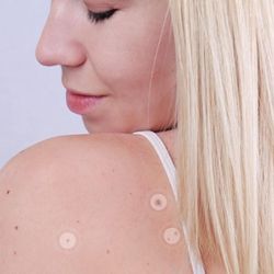 All Natural Anti-Skin Tag Patches