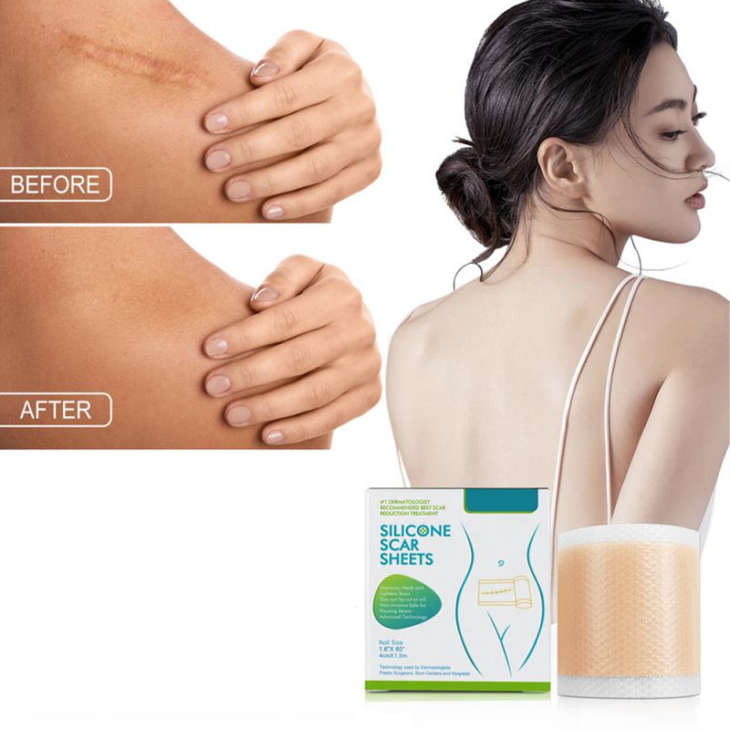 Medicalgrade silicone tape for scar healing