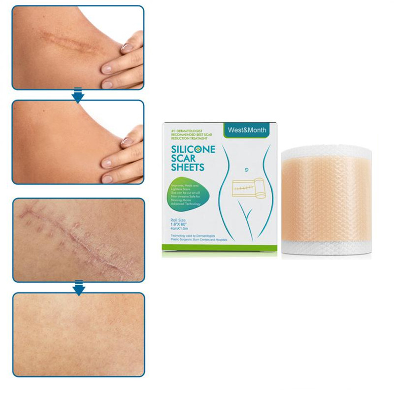 Flexible scar care tape applied on leg