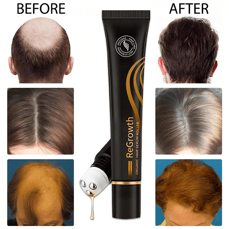 triplerollonmassagerhairgrowthessence4.png
