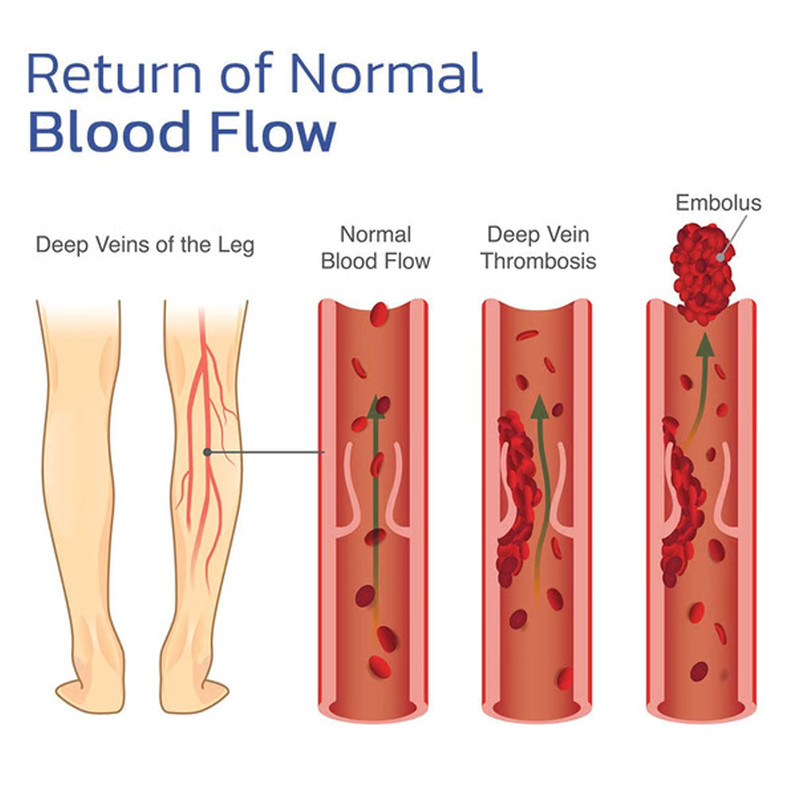 EMS Bioelectric Therapy Acupoint Massaging Body Shaping Mat 5