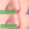 antiacneblackheadremovergreenteamask4.png