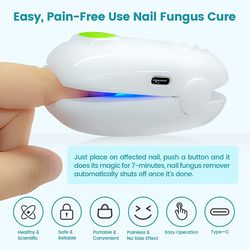 Laser Nail Fungus treatment device Cleaning LaserDevice for Onychomycosis, Revolutionary Home Use Nail-fungus Remover