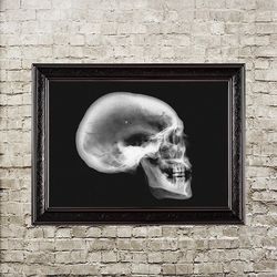 X-ray of a human skull. Anatomical art print. Black and white poster. Dark style gift. 572.