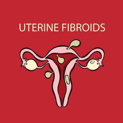 UTERINE FIBROIDS VIDEO Female Reproductive Anatomy Animation