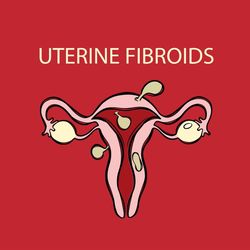 uterine fibroids video female reproductive anatomy animation