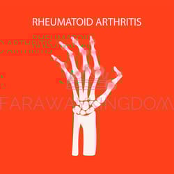 arthritis hand rheumatoid medicine education vector scheme