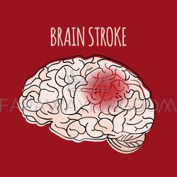 brain stroke insult medicine health vector illustration