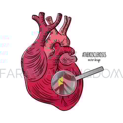 heart disease atherosclerosis medicine education vector scheme