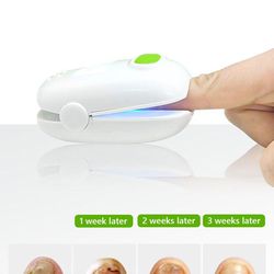 nail fungus cleaning laser device for onychomycosis, revolutionary home use nail-fungus remover nail fungus treatment
