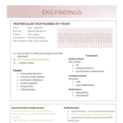 EKG ECG Bundle 2024 | Nursing Bundle | PDF File | Pages 10