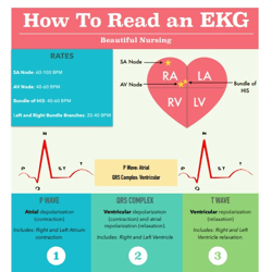 HEART RHYTHMS & ECG | Nursing Bundle | PDF File | Pages 7