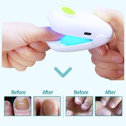laser nail fungus treatment device cleaning laserdevice for onychomycosis, revolutionary home use nail-fungus remover
