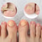 Ingrown Toenail Corrector Patches