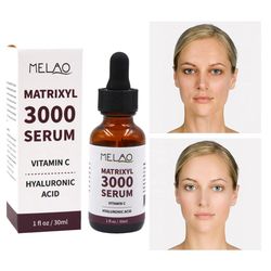 matrixyl 3000 face serum vitamin c hyaluronic acid reduce sun spots wrinkles anti-aging lifting shape korean beauty heal