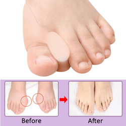 Pexmen 2/4/8pcs Gel Big Toe Separator Bunion Corrector Pain Relief Hallux Valgus Straighter Orthopedic Toe Protector Spa