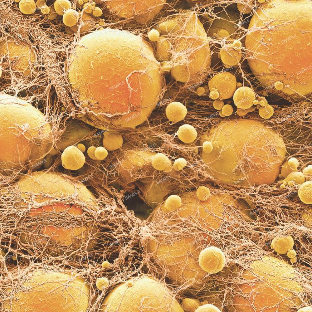 Fat Cells.jpg