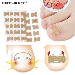 toenail correction stickers ingrown toenail stickers paronychia treatment pedicure toe nail care corrector patch