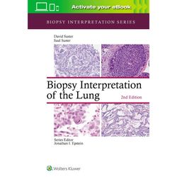Biopsy Interpretation of the Lung 2nd Edition