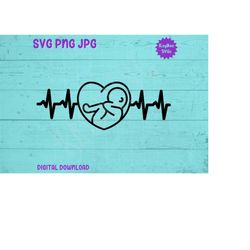 Baby Heartbeat Electrocardiogram SVG PNG JPG Clipart Digital Cut File Download for Cricut Silhouette Sublimation Art - P