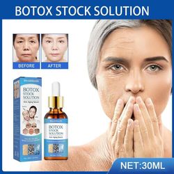 botox wrinkle remover instant anti-aging face serum retinol skin lift